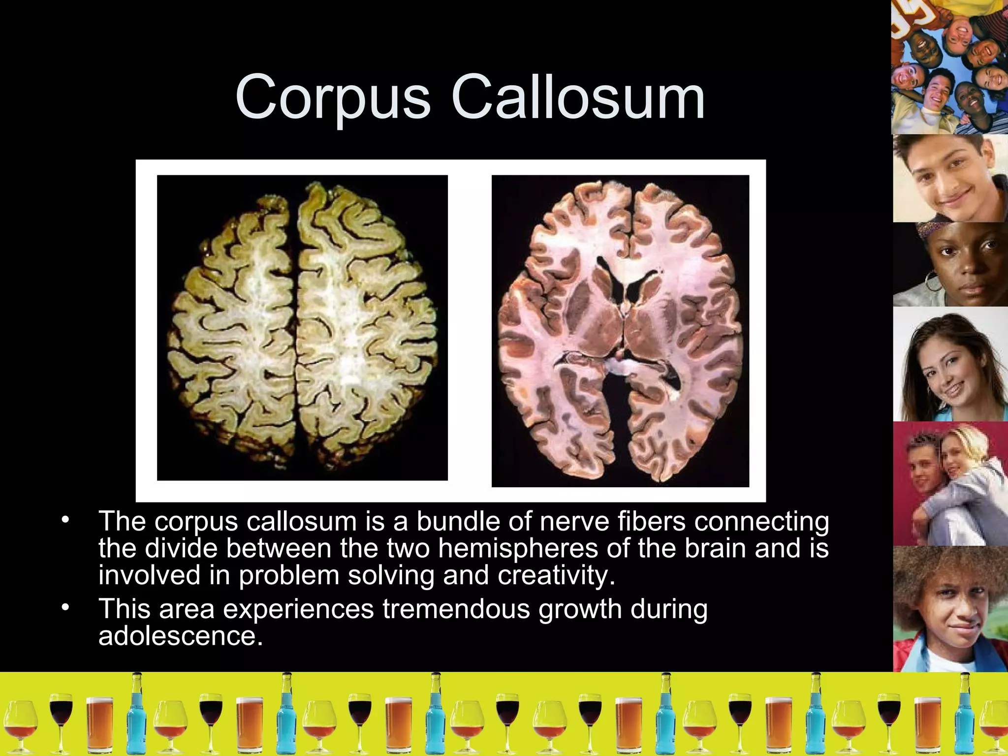 Corpus Callosum The corpus callosum is a bundle of nerve fibers connecting the divide between the two hemispheres of the brain and is involved in problem solving and creativity.  This area experiences tremendous growth during adolescence.  