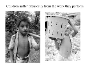 Children suffer physically from the work they perform. 