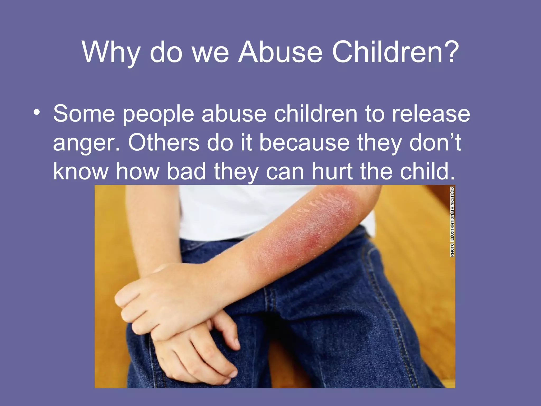 Why do we Abuse Children?
• Some people abuse children to release
anger. Others do it because they don’t
know how bad they can hurt the child.