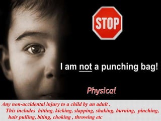 Any non-accidental injury to a child by an adult .
This includes hitting, kicking, slapping, shaking, burning, pinching,
hair pulling, biting, choking , throwing etc
 