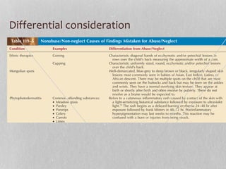 Differential consideration
 