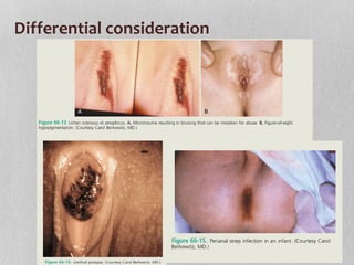 Differential consideration
 