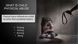 WHAT IS CHILD
PHYSICAL ABUSE
Physical injury inflicted on a child
by other than accidental mean’s.
• Sticking
• Kicking
• Burning
• Biting
 
