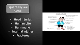 Signs of Physical
Abuse
• Head injuries
• Human bite
• Burn marks
• Internal injuries
• Fractures
 