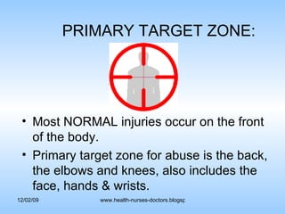 PRIMARY TARGET ZONE: Most NORMAL injuries occur on the front of the body. Primary target zone for abuse is the back, the elbows and knees, also includes the face, hands & wrists. 