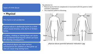 Types of Child abuse
• Physical
This harm is not accidental.
Physical abuse is deliberate harm to a child
which causes bruises, cuts, burns or broken
bones.
In babies, shaking or hitting them can cause
non-accidental head injuries which can have
life-altering consequences.
Any physical abuse can have serious
consequences for children as they grow up
and can cause long lasting harm.
physical-abuse-parental-behavior-indicators-l.jpg
 
