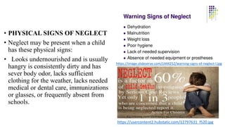 • PHYSICAL SIGNS OF NEGLECT
• Neglect may be present when a child
has these physical signs:
• Looks undernourished and is usually
hangry is consistently dirty and has
sever body odor, lacks sufficient
clothing for the weather, lacks needed
medical or dental care, immunizations
or glasses, or frequently absent from
schools.
https://image.slideserve.com/1444252/warning-signs-of-neglect-l.jpg
https://usercontent2.hubstatic.com/12797631_f520.jpg
 