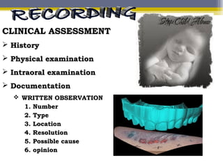 CLINICAL ASSESSMENTCLINICAL ASSESSMENT
 HistoryHistory
 Physical examinationPhysical examination
 Intraoral examinationIntraoral examination
 DocumentationDocumentation
 WRITTEN OBSERVATIONWRITTEN OBSERVATION
1.1. NumberNumber
2.2. TypeType
3.3. LocationLocation
4.4. ResolutionResolution
5.5. Possible causePossible cause
6.6. opinionopinion
 
