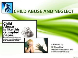 CHILD ABUSE AND NEGLECT
Presented by:
Dr Divya Gaur
Dept of Pedodontics and
Preventive Dentistry
 