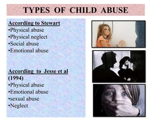 According to Stewart
•Physical abuse
•Physical neglect
•Social abuse
•Emotional abuse
According to Jesse et al
(1994)
•Physical abuse
•Emotional abuse
•sexual abuse
•Neglect
TYPES OF CHILD ABUSE
 