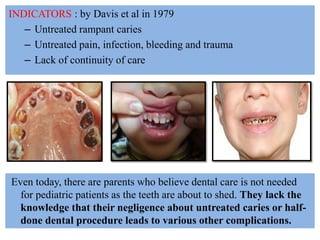 INDICATORS : by Davis et al in 1979
– Untreated rampant caries
– Untreated pain, infection, bleeding and trauma
– Lack of continuity of care
Even today, there are parents who believe dental care is not needed
for pediatric patients as the teeth are about to shed. They lack the
knowledge that their negligence about untreated caries or half-
done dental procedure leads to various other complications.
 
