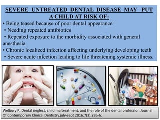 SEVERE UNTREATED DENTAL DISEASE MAY PUT
A CHILD AT RISK OF:
• Being teased because of poor dental appearance
• Needing repeated antibiotics
• Repeated exposure to the morbidity associated with general
anesthesia
• Chronic localized infection affecting underlying developing teeth
• Severe acute infection leading to life threatening systemic illness.
Welbury R. Dental neglect, child maltreatment, and the role of the dental profession.Journal
Of Contemporery Clinical Dentistry.july-sept 2016.7(3);285-6.
 