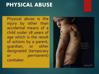 PHYSICAL ABUSE
 Physical abuse is the
injury by other than
accidental means of a
child under 18 years of
age which is the result
of actions by a parent,
guardian, or other
designated (temporary
or permanent)
caretaker.
 