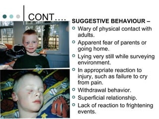 CONT…. SUGGESTIVE BEHAVIOUR –
 Wary of physical contact with
adults.
 Apparent fear of parents or
going home.
 Lying very still while surveying
environment.
 In appropriate reaction to
injury, such as failure to cry
from pain.
 Withdrawal behavior.
 Superficial relationship.
 Lack of reaction to frightening
events.
 