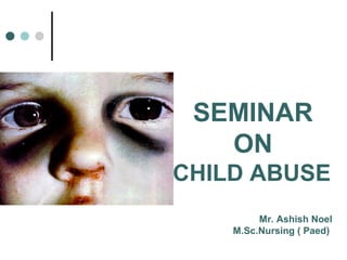 SEMINAR
   ON
CHILD ABUSE
         Mr. Ashish Noel
    M.Sc.Nursing ( Paed)
 