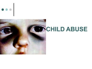 CHILD ABUSE
 