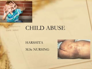 CHILD ABUSE
HARSHITA
M.Sc NURSING
 