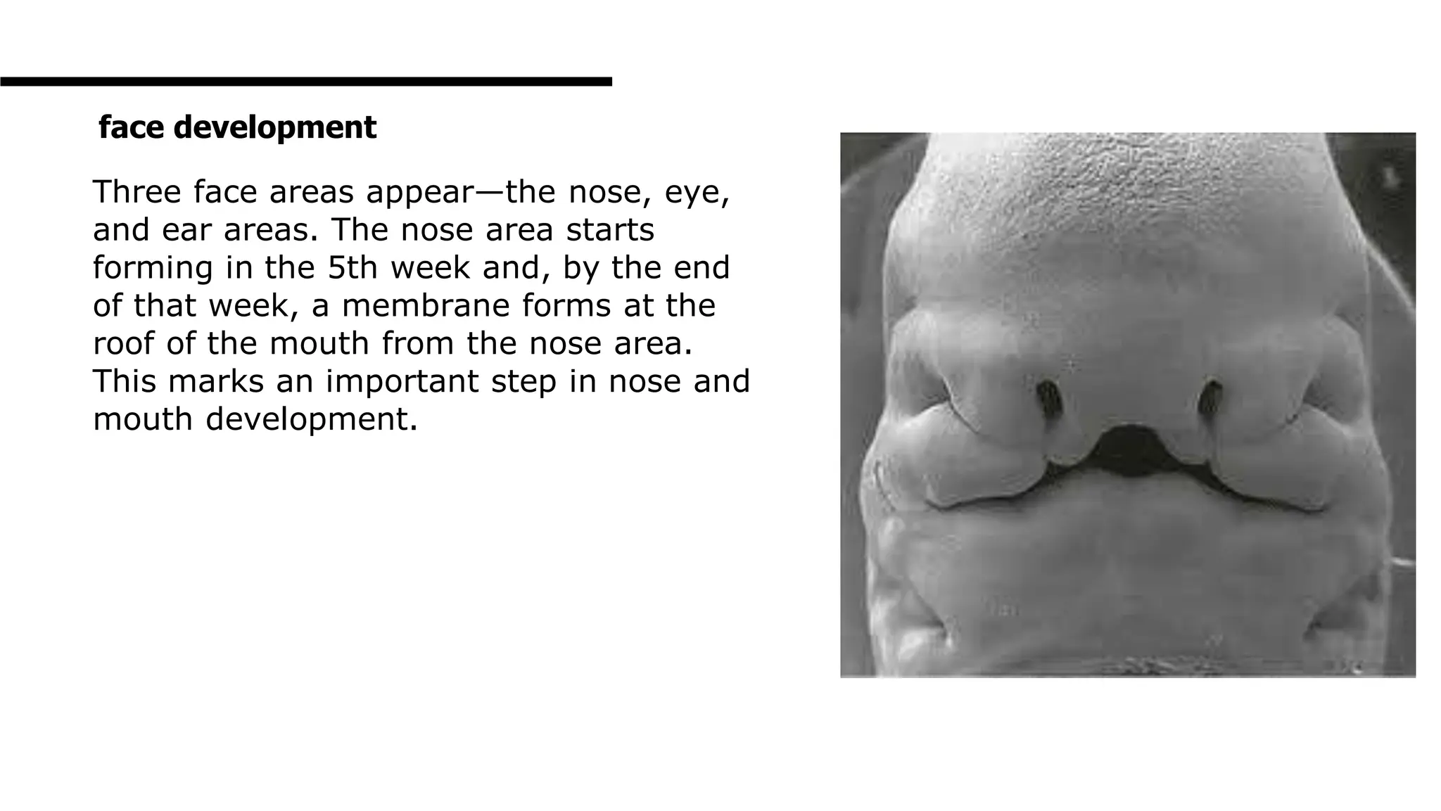 Three face areas appear—the nose, eye,
and ear areas. The nose area starts
forming in the 5th week and, by the end
of that week, a membrane forms at the
roof of the mouth from the nose area.
This marks an important step in nose and
mouth development.
face development
 
