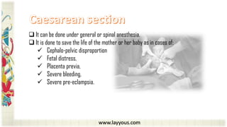 www.layyous.com
 It can be done under general or spinal anesthesia.
 It is done to save the life of the mother or her baby as in cases of:
 Cephalo-pelvic disproportion
 Fetal distress,
 Placenta previa,
 Severe bleeding,
 Severe pre-eclampsia.
 