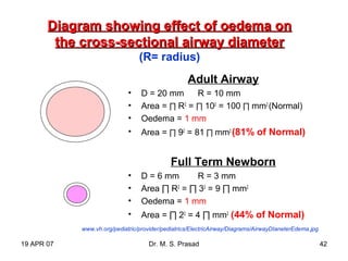 19 APR 07 Dr. M. S. Prasad 42
Diagram showing effect of oedema onDiagram showing effect of oedema on
the cross-sectional airway diameterthe cross-sectional airway diameter
(R= radius)
Adult Airway
• D = 20 mm R = 10 mm
• Area = ∏ R2
= ∏ 102
= 100 ∏ mm2
(Normal)
• Oedema = 1 mm
• Area = ∏ 92
= 81 ∏ mm2
(81% of Normal)
Full Term Newborn
• D = 6 mm R = 3 mm
• Area ∏ R2
= ∏ 32
= 9 ∏ mm2
• Oedema = 1 mm
• Area = ∏ 22
= 4 ∏ mm2
(44% of Normal)
www.vh.org/pediatric/provider/pediatrics/ElectricAirway/Diagrams/AirwayDIaneterEdema.jpg
 