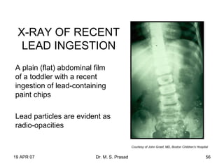 19 APR 07 Dr. M. S. Prasad 56
X-RAY OF RECENT
LEAD INGESTION
A plain (flat) abdominal film
of a toddler with a recent
ingestion of lead-containing
paint chips
Lead particles are evident as
radio-opacities
Courtesy of John Graef, MD, Boston Children's Hospital
 