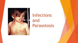 Infections
and
Parasotosis
 