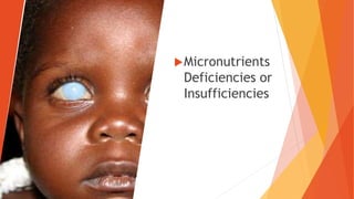 Micronutrients
Deficiencies or
Insufficiencies
 