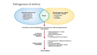 Childhood Asthma.pptx lecture of childhood asthma | PPTX