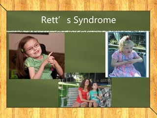 Rett’s Syndrome
 