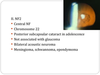 Nf2 Child Childhood glaucoma | PPT