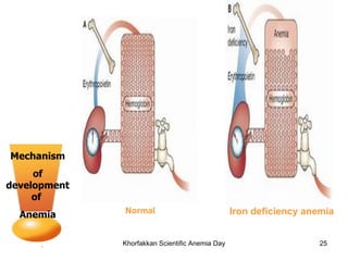 Mechanism of development of  Anemia Normal Iron deficiency anemia 