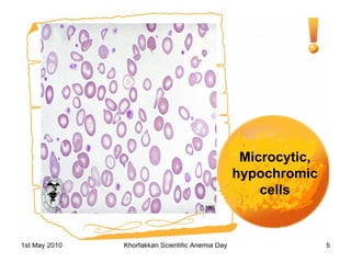 Microcytic, hypochromic cells 