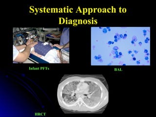 Systematic Approach toSystematic Approach to
DiagnosisDiagnosis
Infant PFTs BAL
HRCT
 