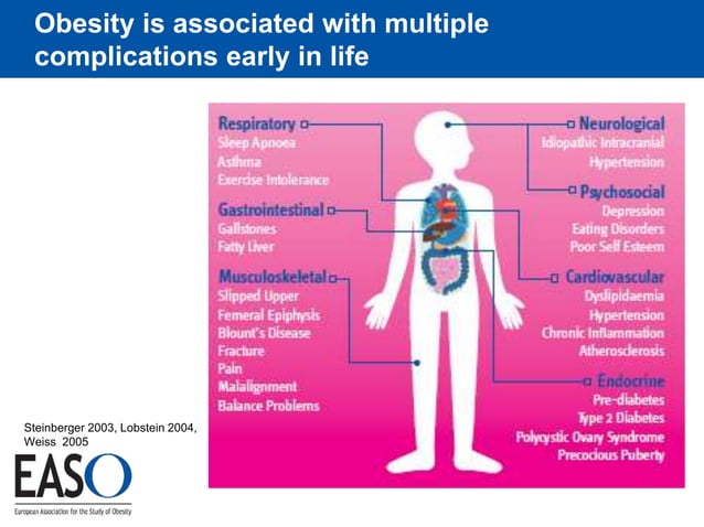 Childhood obesity by EASO | PPT
