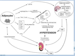 obesity insulin
resistance
hyperinsulinemia
increases
the
sympatheti
c activity
Increases the activity in
the renin-angiotensin
system
hypertension
 