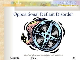 04/09/16 JStar 30
Oppositional Defiant Disorder
http://www.hsc.wvu.edu/aap/aap-car/videos.htm
 