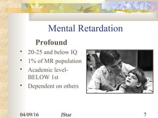 04/09/16 JStar 7
Mental Retardation
Profound
 20-25 and below IQ
 1% of MR population
 Academic level-
BELOW 1st
 Dependent on others
 