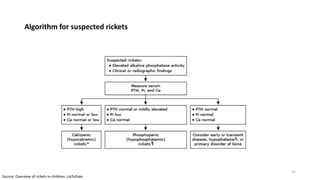 An Overview of Childhood Rickets | PPTX