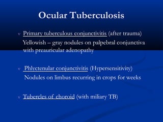 Ocular Tuberculosis
 Primary tuberculous conjunctivitis (after trauma)
Yellowish – gray nodules on palpebral conjunctiva
with preauricular adenopathy
 Phlyctenular conjunctivitis (Hypersensitivity)
Nodules on limbus recurring in crops for weeks
 Tubercles of choroid (with miliary TB)
 