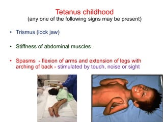 Tetanus Arm Example Childhood tetanus 2021 | PDF