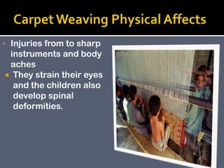 ▪ Injuries from to sharp
instruments and body
aches
 They strain their eyes
and the children also
develop spinal
deformities.

 