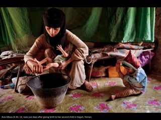Asia Albuss Al Ali, 14, rests just days after giving birth to her second child in Hajjah, Yemen.
 