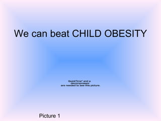 We can beat CHILD OBESITY Picture 1 