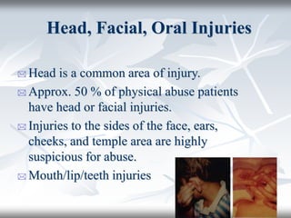 Head, Facial, Oral Injuries
 Head is a common area of injury.
 Approx. 50 % of physical abuse patients
have head or facial injuries.
 Injuries to the sides of the face, ears,
cheeks, and temple area are highly
suspicious for abuse.
 Mouth/lip/teeth injuries
 