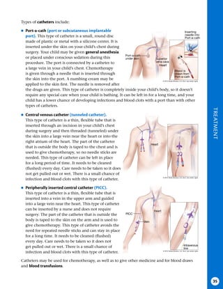 TREATMENT
35
Types of catheters include:
●
● Port-a-cath (port or subcutaneous implantable
port) . This type of catheter is a small, round disc
made of plastic or metal with a silicone center. It is
inserted under the skin on your child’s chest during
surgery. Your child may be given general anesthesia
or placed under conscious sedation during this
procedure. The port is connected by a catheter to
a large vein in your child’s chest. Chemotherapy
is given through a needle that is inserted through
the skin into the port. A numbing cream may be
applied to the skin first. The needle is removed after
the drugs are given. This type of catheter is completely inside your child’s body, so it doesn’t
require any special care when your child is bathing. It can be left in for a long time, and your
child has a lower chance of developing infections and blood clots with a port than with other
types of catheters.
Port-a-cath
under skin
Heart
Superior
vena cava
Inserting
needle into
Port-a-cath
Blood is
drawn from
Port-a-cath
Central
venous
catheter
●
● Central venous catheter (tunneled catheter) .
This type of catheter is a thin, flexible tube that is
inserted through an incision in your child’s chest
during surgery and then threaded (tunneled) under
the skin into a large vein near the heart or into the
right atrium of the heart. The part of the catheter
that is outside the body is taped to the chest and is
used to give chemotherapy, so no needle sticks are
needed. This type of catheter can be left in place
for a long period of time. It needs to be cleaned
(flushed) every day. Care needs to be taken so it does
not get pulled out or wet. There is a small chance of
infection and blood clots with this type of catheter.
●
● Peripherally inserted central catheter (PICC) .
This type of catheter is a thin, flexible tube that is
inserted into a vein in the upper arm and guided
into a large vein near the heart. This type of catheter
can be inserted by a nurse and does not require
surgery. The part of the catheter that is outside the
body is taped to the skin on the arm and is used to
give chemotherapy. This type of catheter avoids the
need for repeated needle sticks and can stay in place
for a long time. It needs to be cleaned (flushed)
every day. Care needs to be taken so it does not
get pulled out or wet. There is a small chance of
infection and blood clots with this type of catheter.
Catheters may be used for chemotherapy, as well as to give other medicine and for blood draws
and blood transfusions.
Heart
Vein
Intravenous
line
PICC
Heart
© 2015 Terese Winslow, U.S. Govt. has certain rights
© 2015 Terese Winslow, U.S. Govt. has certain rights
© 2015 Terese Winslow, U.S. Govt. has certain rights
 