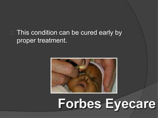 This condition can be cured early by
proper treatment.
 