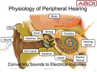 Converting Sounds to Electrical Impulses
Pinna
Ear Canal
Brain
Liquid
Hearing
Nerve
Electric
Stimuli
Cochlea
Eardrum
Sound
Physiology of Peripheral Hearing
Hammer
Stirrup
Anvil
9/6/2015 Manfred Stoifl
12
 