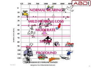z v
p
h
g
ch
shl
roa
sf th
j mdb
n
nge i
u
AUDIOGRAMOF FAMILIARSOUNDS
FREQUENCY IN CYCLES PERSECOND(HZ)
10
0
30
40
50
60
70
80
90
100
110
120
125 250 500 1000 2000 4000 8000
HEARINGLEVEL(dBHL)
20
NORMALHEARING
MILD HEARINGLOSS
MODERATE
SEVERE
PROFOUND
9/6/2015 Manfred Stoifl
29
 