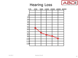 Hearing Loss
10
0
20
30
40
50
60
70
80
90
100
110
120
125 250 500 1000 2000 4000 8000
9/6/2015 Manfred Stoifl
30
 