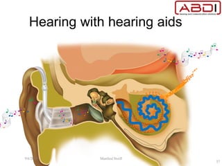 Hearing with hearing aids
9/6/2015 Manfred Stoifl
37
 
